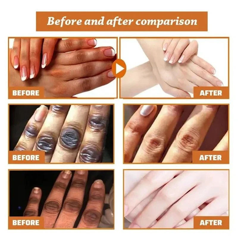 Thumbnail: Fast Brighten Dark Knuckles Cream Whiting Hand Cream Lighten Melanin Stains Corr