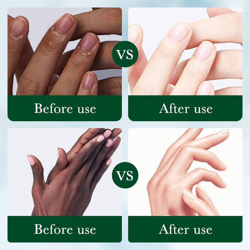 Thumbnail: Fast Brighten Dark Knuckles Cream Whiting Hand Cream Lighten Melanin Stains Corr