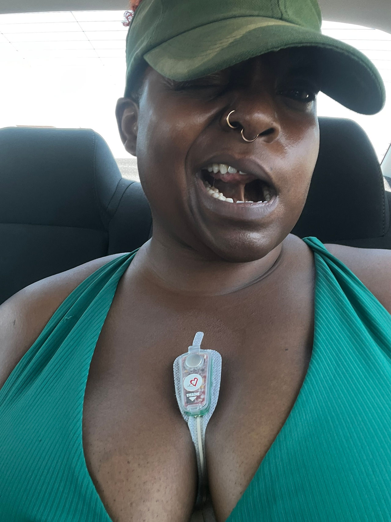 Selfie of Kiing Curry sitting in the back seat of a car a few days after surgery. They wear a green athletic top and matching visor, wink playfully at the camera, and have a small medical dressing with tubing attached at the center of their upper chest. The image captures recovery with humor, resilience, and visible signs of healing.