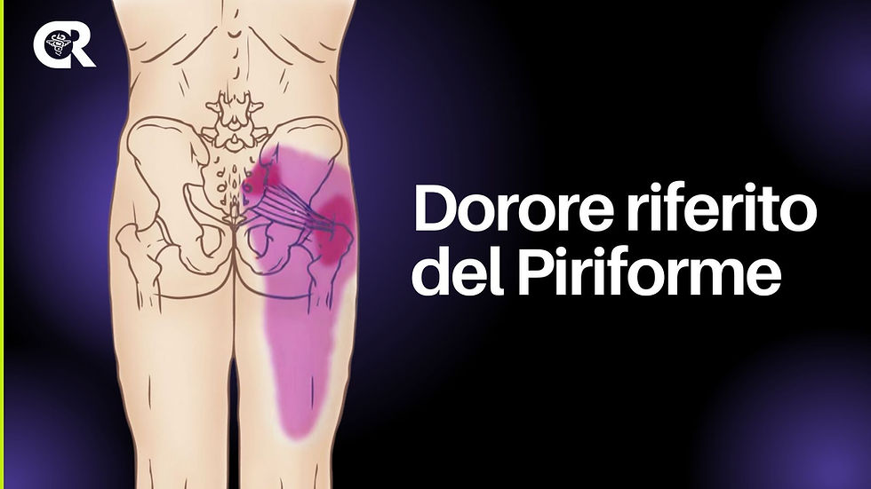 dolore riferito del muscolo piriforme
