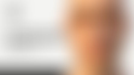 Paralisi di Bell: guida completa per il paziente