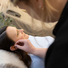 ear acupuncture