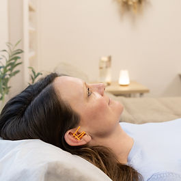 ear acupuncture