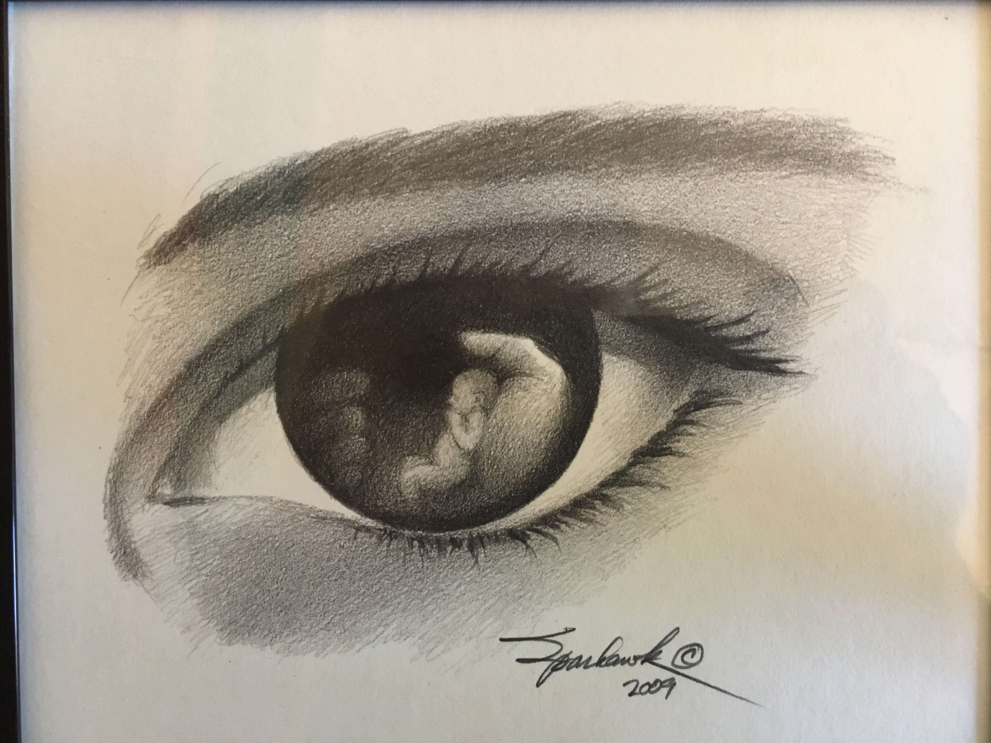 Eye with infant in it