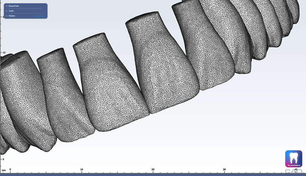 Dental CE in Miami Digital Dentistry Courses