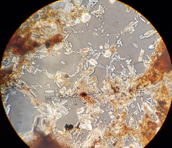 Soil diatoms under microscope