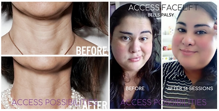 BeforeAfter.png