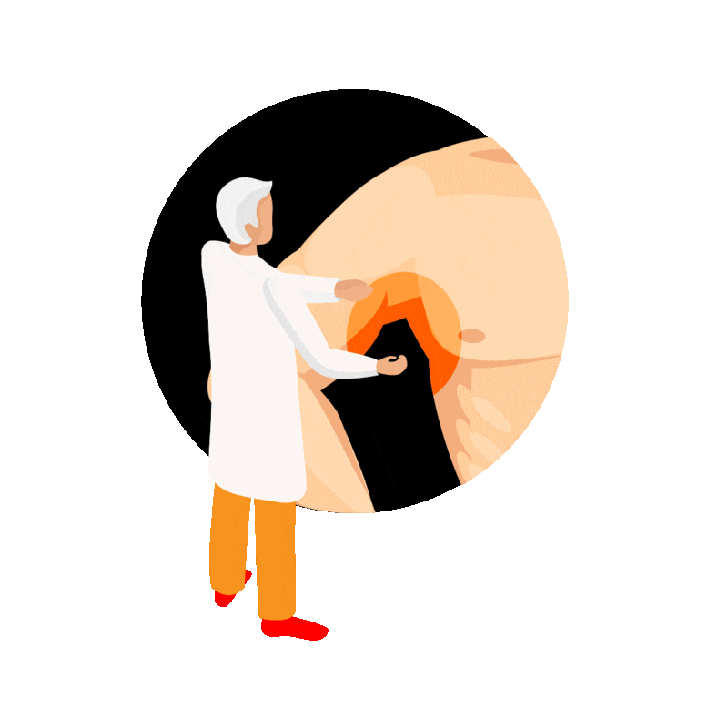 Skin-Container-Inspection01.gif