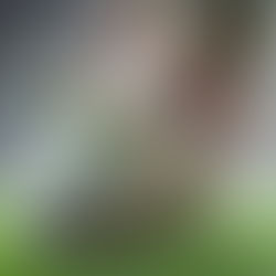 Fracturas de Estrés en Deportistas: Diagnóstico y Recuperación