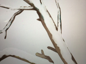 無題のブログ記事