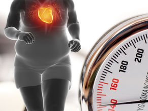 Impacto de la obesidad en la presión arterial