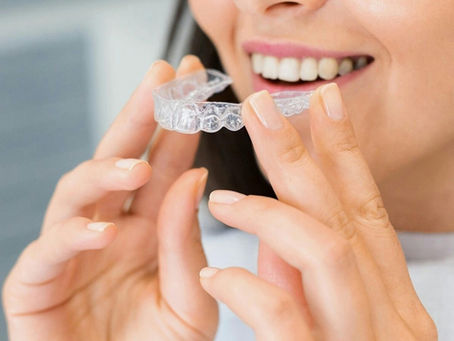 Are Braces Cheaper Than Invisalign? Cost Comparisons in Edmonton