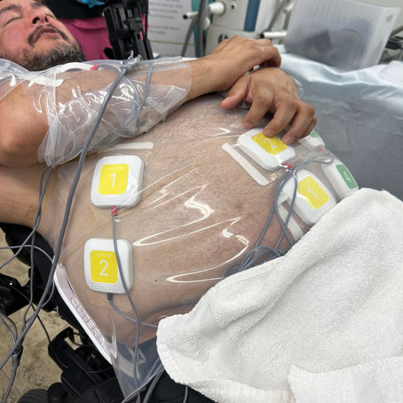 A Quadriplegic Patient’s TruFlex Journey
