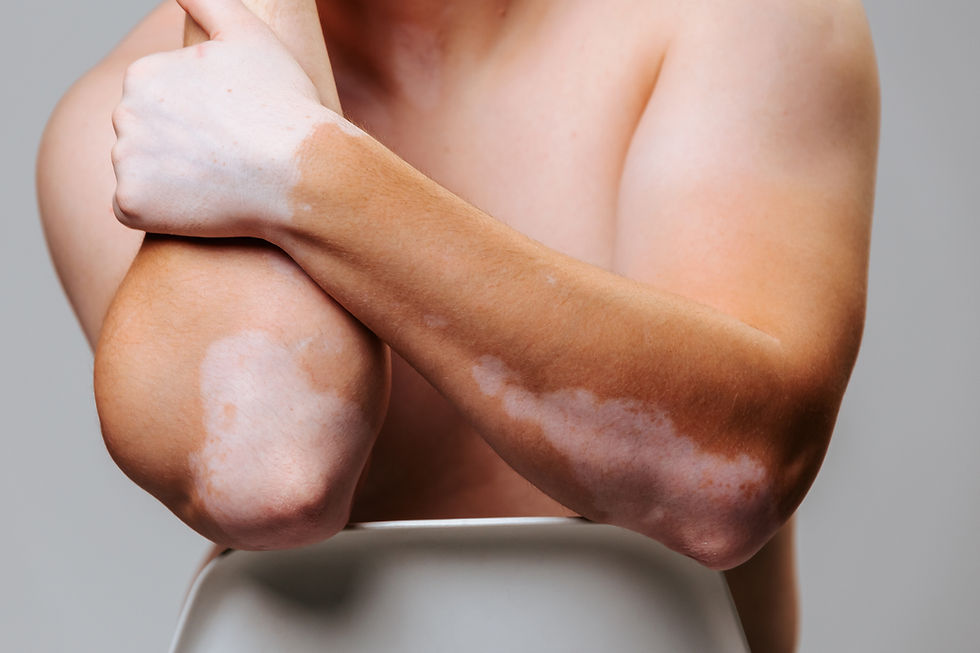 Professional skincare treatment addressing pigmentation concerns at Devenir Aesthetics