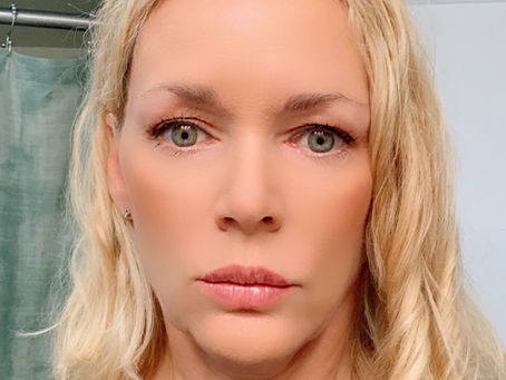 My Massage Envy Chemical Peel