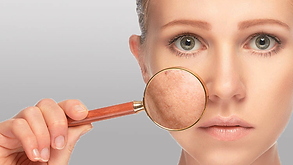 pores-dilates-visage.png