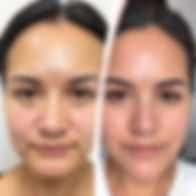 before and after skincare.jpg