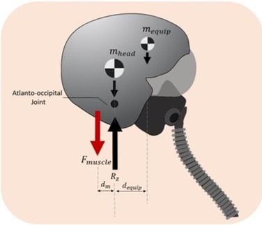 Diagram of forces acting on the head and neck of air force pilot.