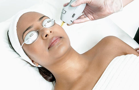 adelfi laser facial collagen vriginia springfield best.jpg