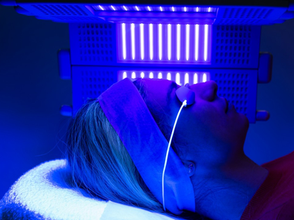 Exploring the 5 Benefits of LED Light Therapy for Acne
