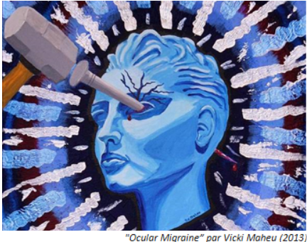 Briser les maux de tête un pas à la fois