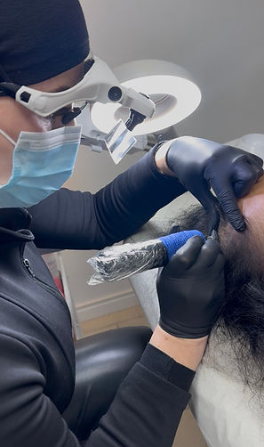 Profesional realizando tratamiento micropigmentación Capilar Clínica Estética Concepción