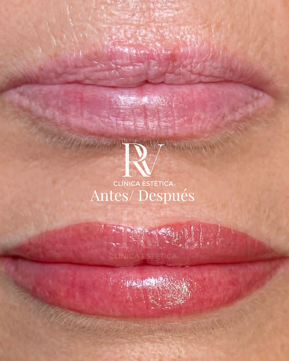 Antes y después Microblading de labios Clínica Estética RV Concepción