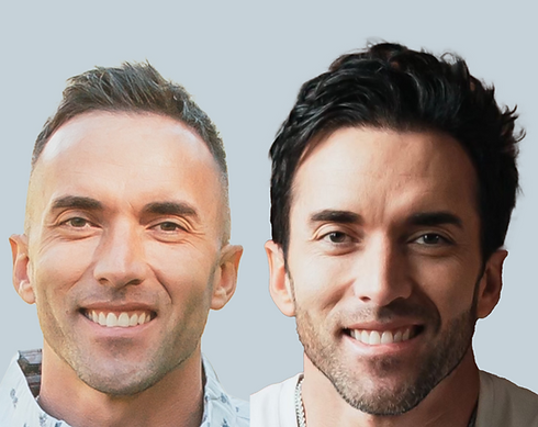 SP Med Before and After Photo A v4.png