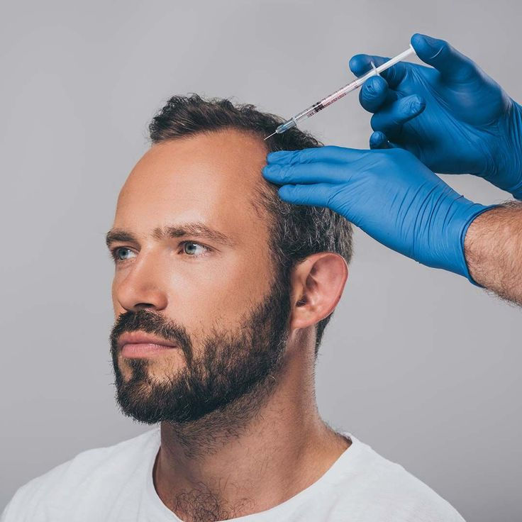 PRP treatment.jpg