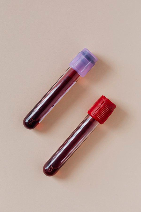 PRP treatment 4.jpg