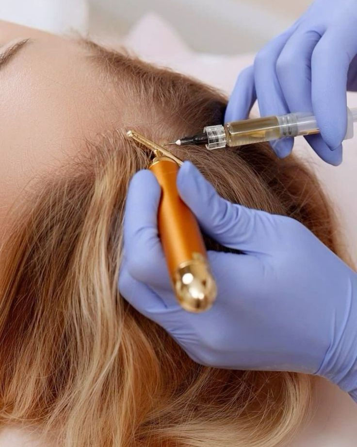 PRP treatment 1.jpg