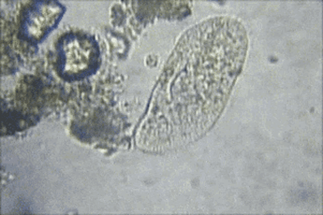 diatoms.gif