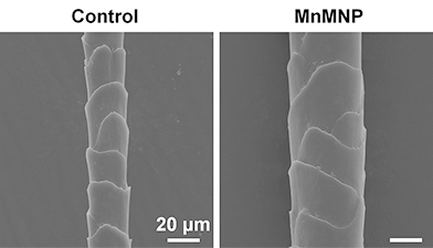 AI helps researchers design micro-needle patches that restore hair in balding mice