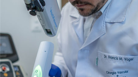 Conheça opções de tratamento para varizes na Clínica Vogel