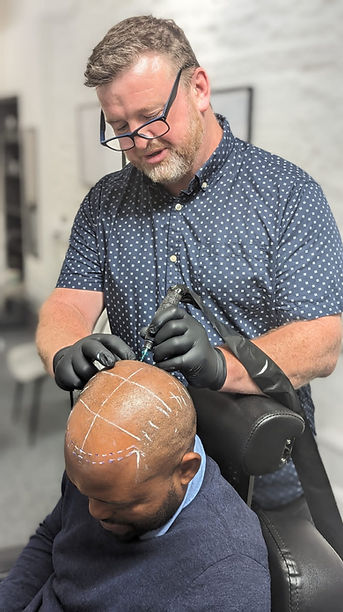 Our Specialist Healthcare Practitioner performs Scalp Micro Pigmentation to disguise hair loss