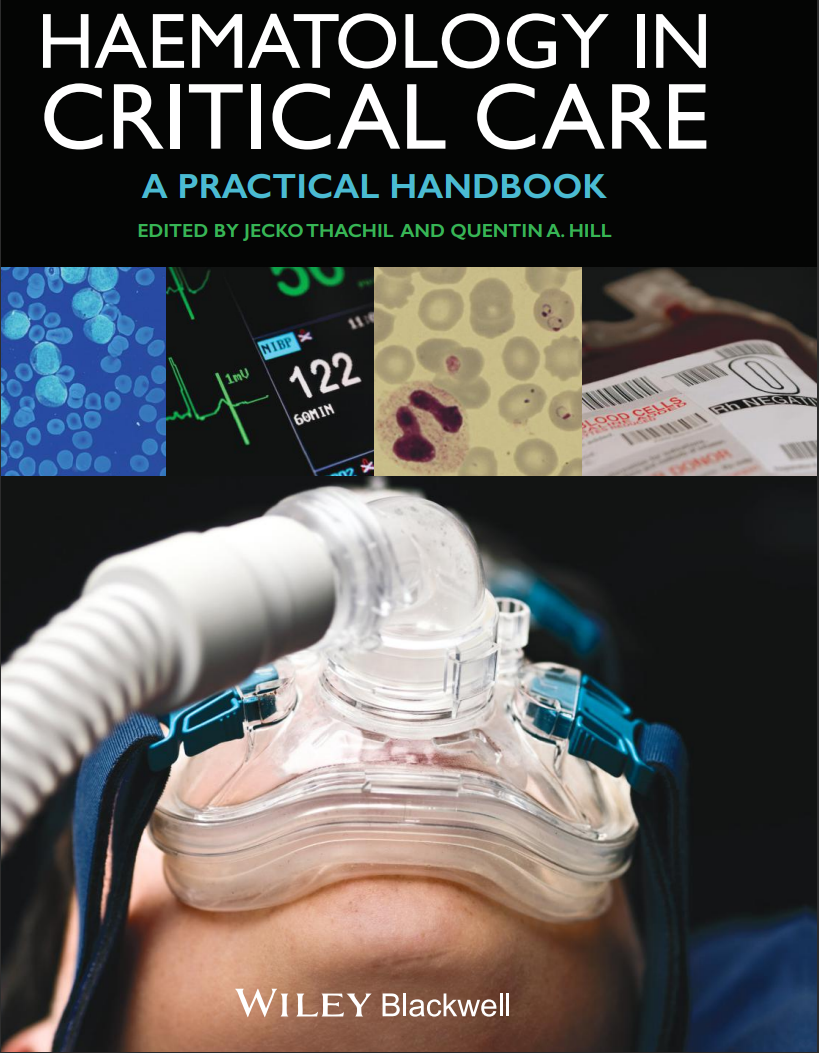 Haematology in Critical Care: A Practical Handbook 1st Edition, Kindle Edition