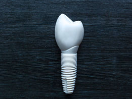 A look at Ceramic Dental Implants at Swiss Biologic Dentistry (1 of 3)