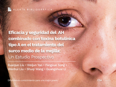 Eficacia y seguridad del AH combinado con toxina botulínica tipo A en el tratamiento del surco medio de la mejilla: Un Estudio Prospectivo