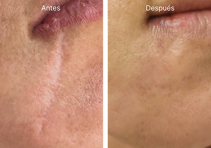 skingenuity antes y después
