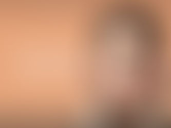 La Superioridad del ácido poliláctico (ácido poli-l-láctico - PLLA) en rellenos dérmicos