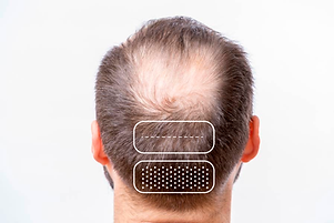 FUT-FUE.png