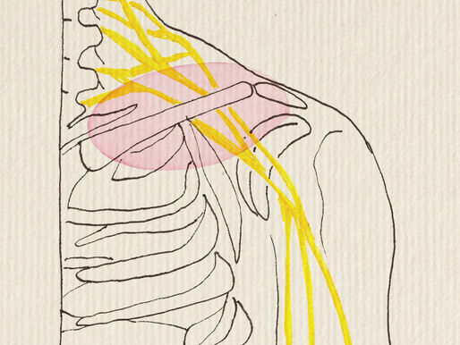 SE ME DUERME EL BRAZO, TENGO HERNIA DE DISCO CERVICAL…!