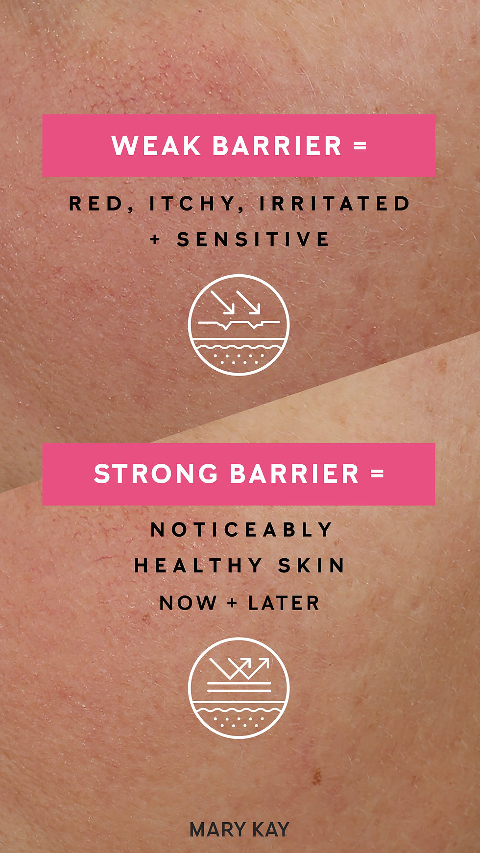 Weak skin barrier versus strong skin barrier—weak barrier lets moisture escape and irritants in (dry, tight, red, reactive skin); strong barrier locks in hydration and protects for calm, smooth, comfortable skin.