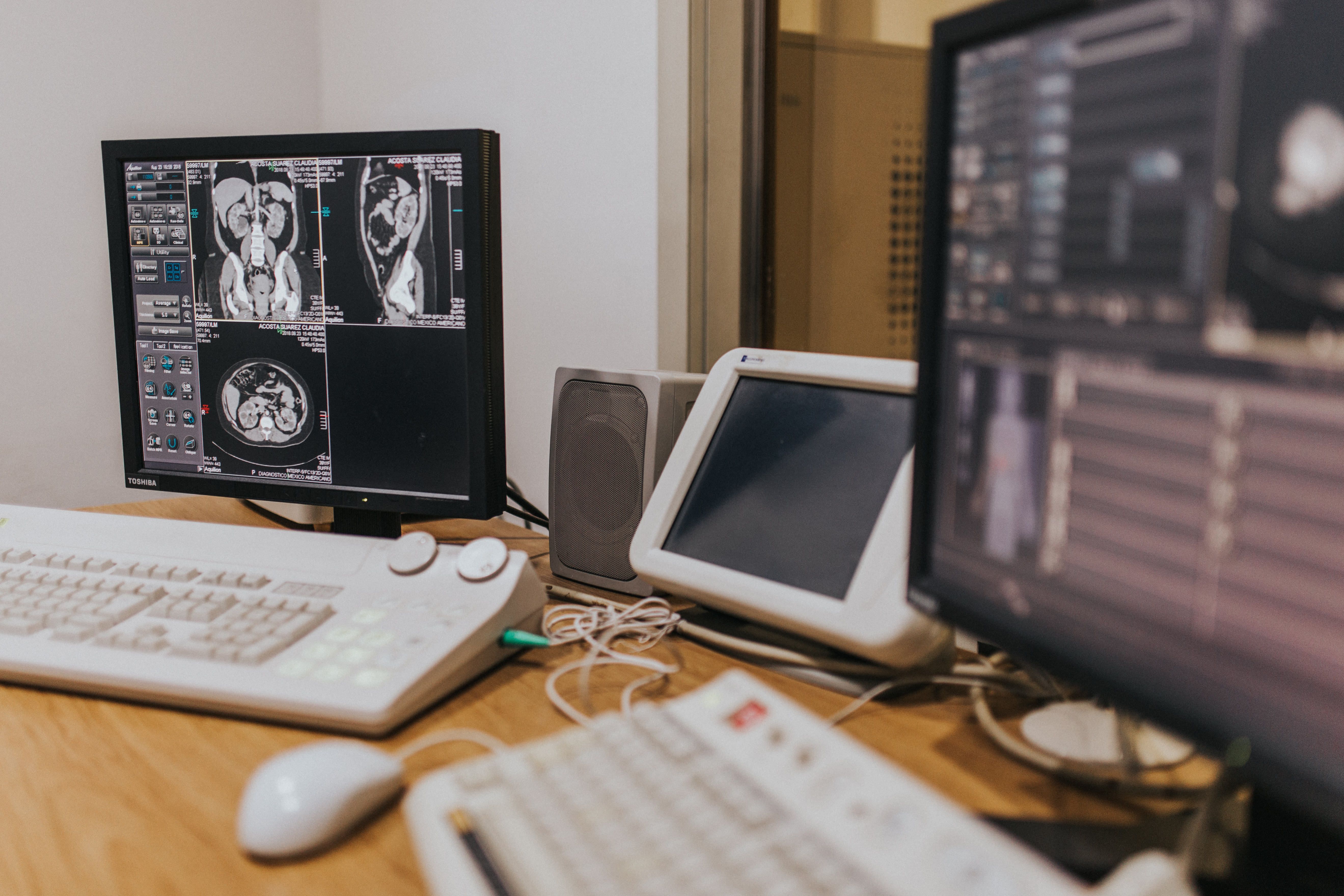 Medical imaging displayed across hospital computer screens