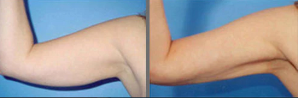 Screen Shot 2023-12-11 at 2.27.42 PM.png