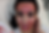 Kim Kardashian Vampire Facial Treatment