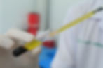 PRP Infusion