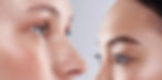 Ultherapy Collagan Stimulation