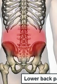 low back pain 5_edited.jpg