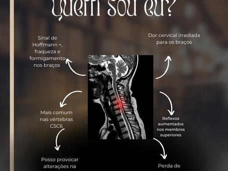 Sinais característicos da Mielopatia Cervical